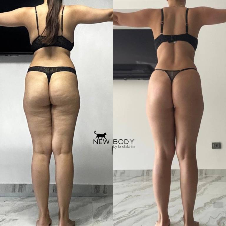 rezultate Ionela Ichim New Body Inainte si dupa (3)