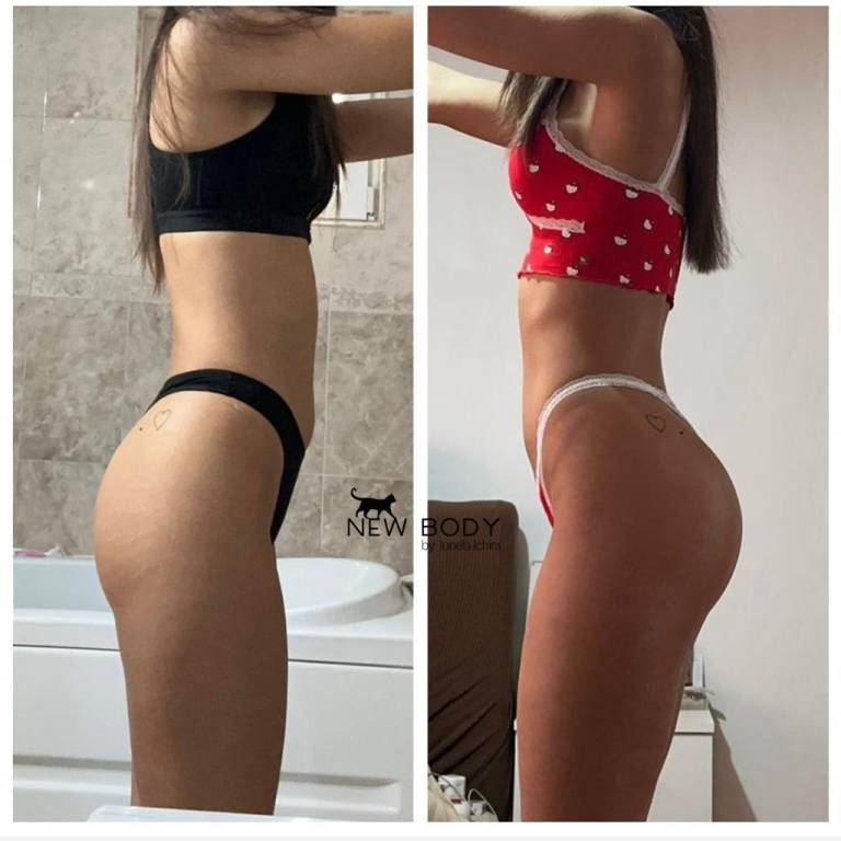 rezultate Ionela Ichim New Body Inainte si dupa (3)