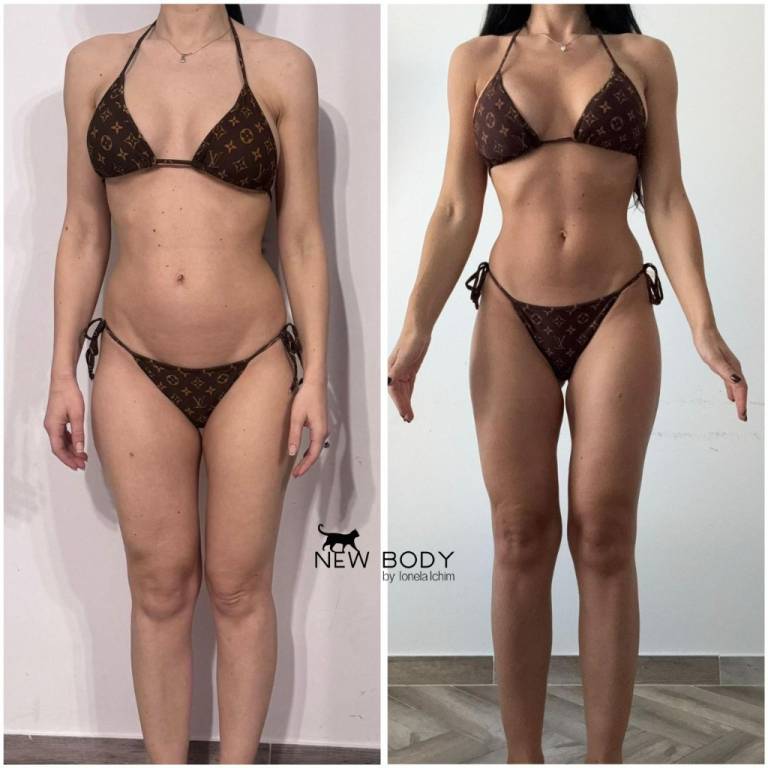 rezultate Ionela Ichim New Body Inainte si dupa (1)